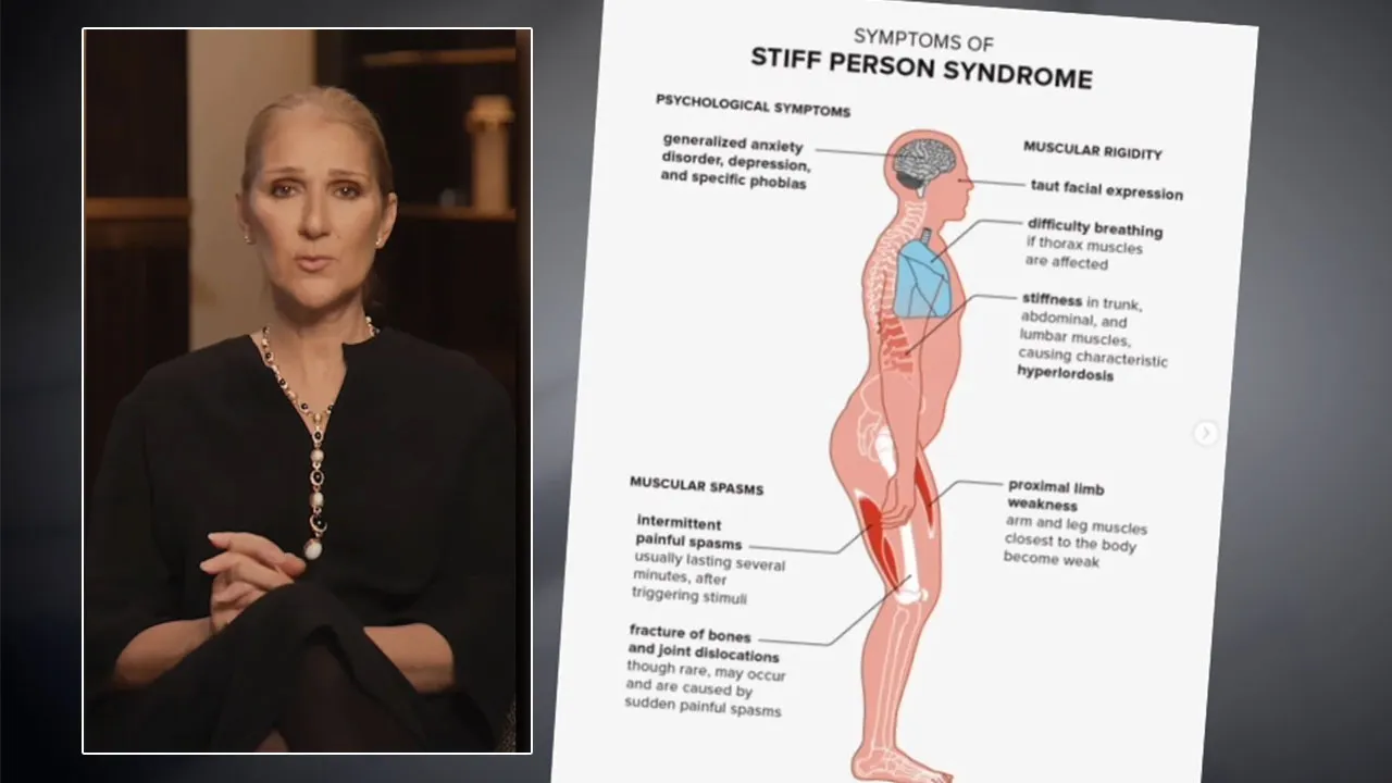 Stiff-Person Syndrome